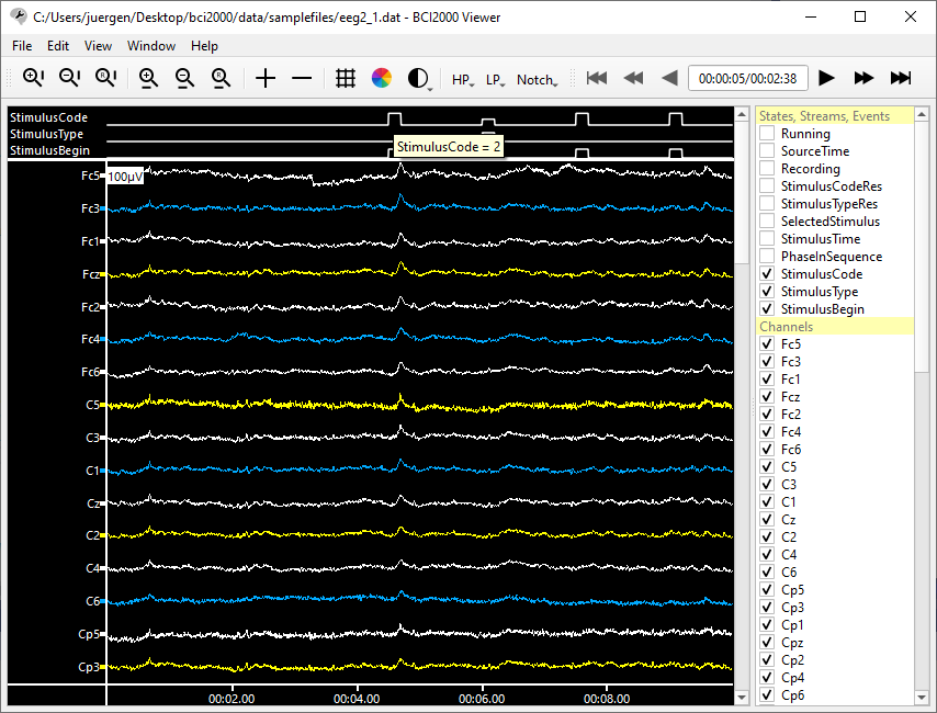 Image:BCI2000Viewer.PNG