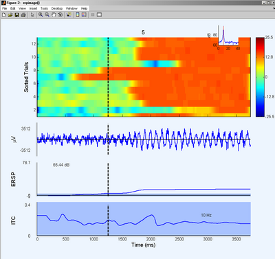 ERP Image for TargetCode = 1