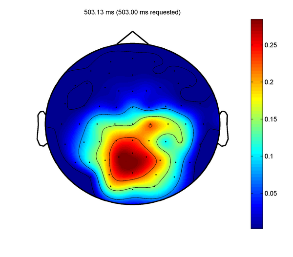 Eeg2Topo.png