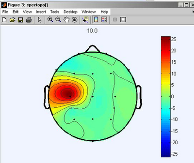 Spectral map for 10 Hz