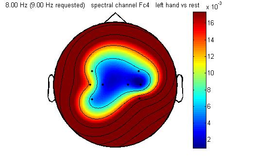 total left hand vs rest topgraphy.jpg