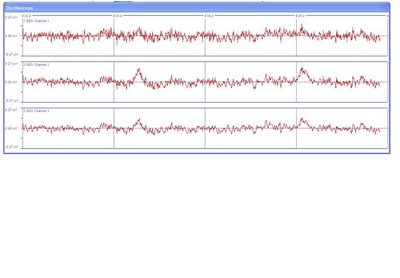 Signals in Brainbay