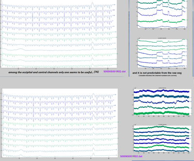 the 128 nets has one usable channel.png
