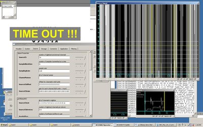 Malconfigured EEG